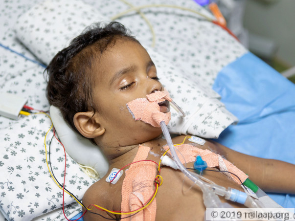 This 1-Year-Old's Vital Organs Will Fail Without Urgent Treatment