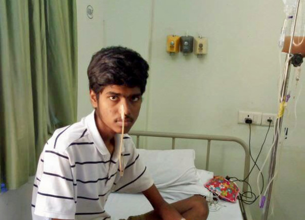 Tropical chronic pancreatitis (TCP