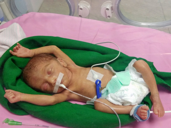 Help Female Baby of Rani & Gorakh Mawurya
