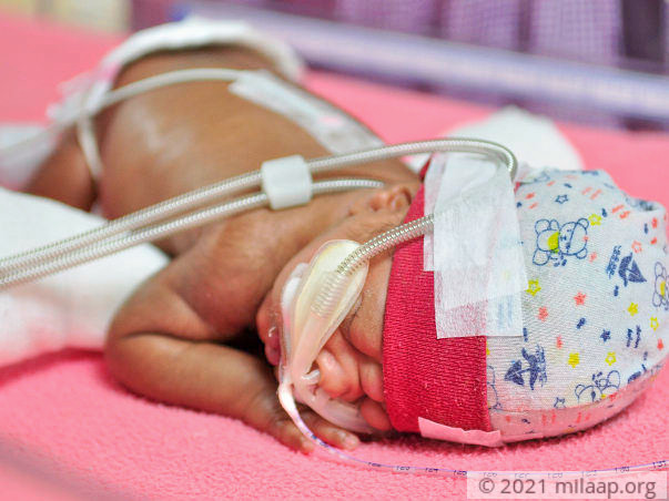 Help Lata and Suresh save their 3 week old baby