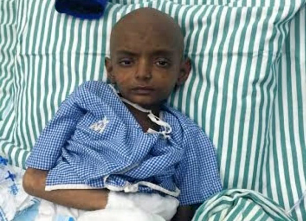 7-Year-Old Ansh Fights A Terrible Disease And Needs Our Help To Live
