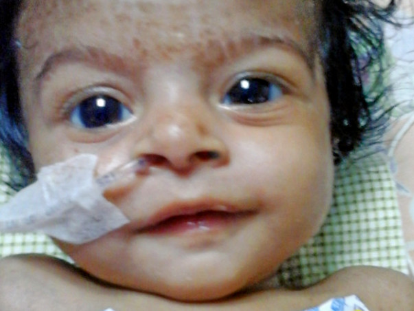 Seeking Support To Save My 3-Month-Old Daughter
