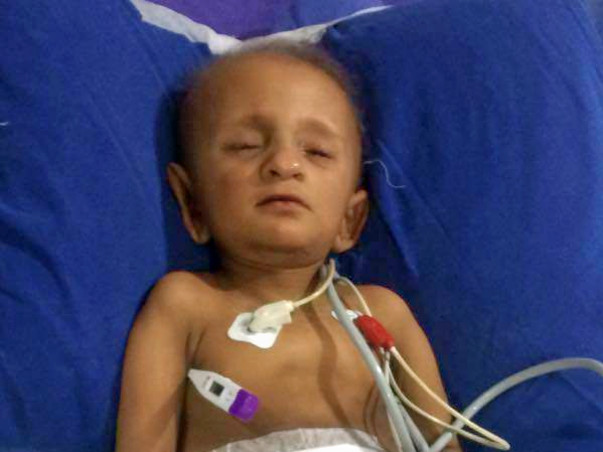 My 2 year 0ld son suffering from kidney cancer