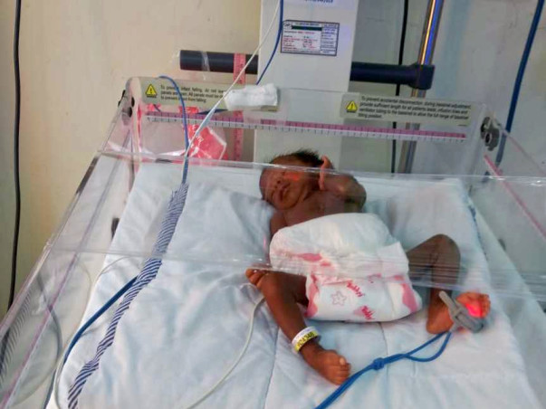 Help For Premature Twins of Sayantani.