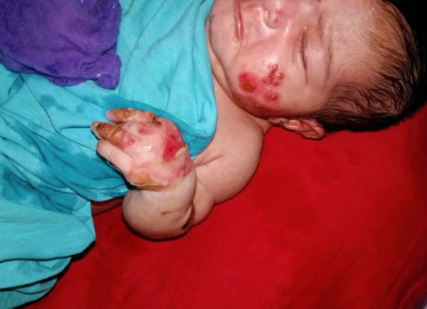 My 10-day Old daughter Is Suffering From A Skin Condition Please Help.