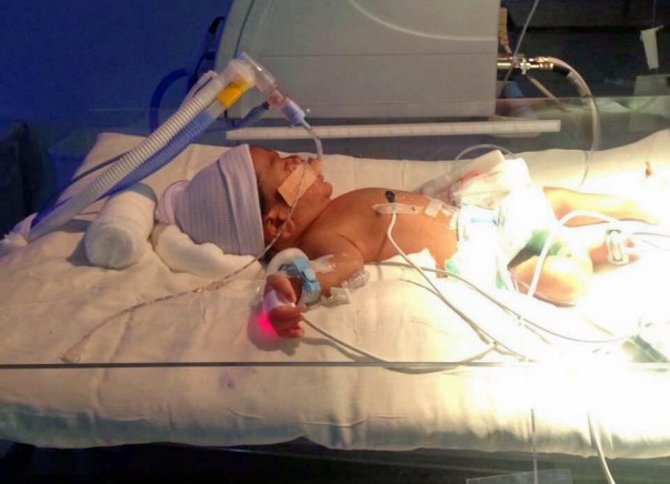 Help This 6-Day-Old Baby Stay Alive