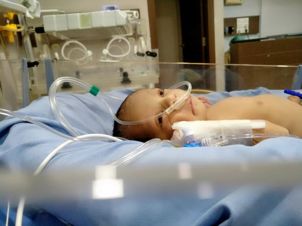 4-day-old Baby Will Suffocate To Death Unless He Has A Surgery