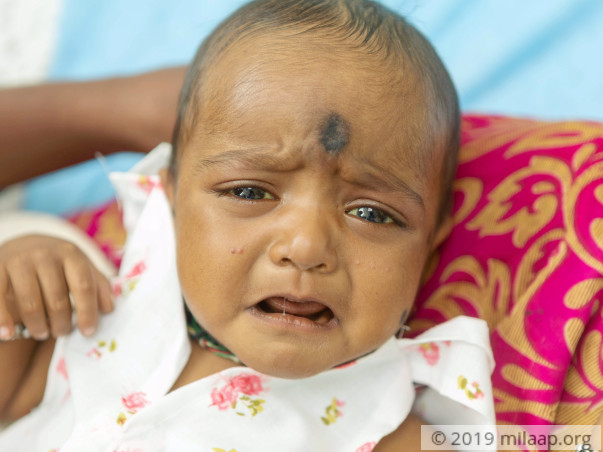 Baby With Painfully Swollen Stomach Needs Urgent Liver Transplant
