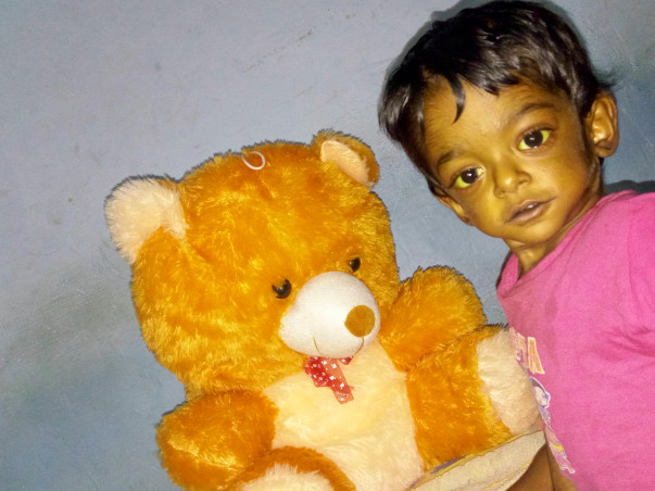 LIVER TRANSPLANTION Today (9-may-17) for my 2yr old son Kapil Abhinav