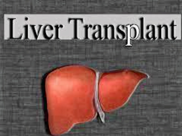 I am fundraising to husband's Liver Transplant