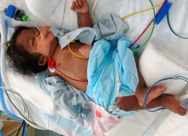This 5-Month-Old Baby Needs Your Urgent Support To Stay Alive