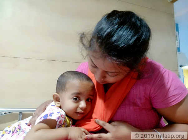 Cancer Will Blind This 1-year-old Baby Girl If She Does Not Get Help