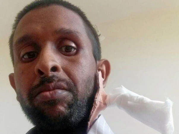 Help Murtuja Undergo Dialysis For His Kidney Failure