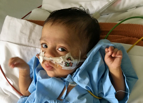 Save Baby Ashwanth From Chronic Lung Disease