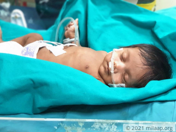 Baby of Mrs.Ganga Gore needs your help to survive