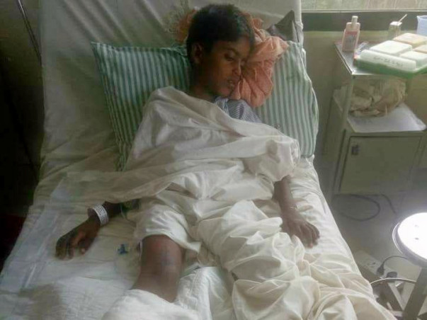 surgery for Jashwant
