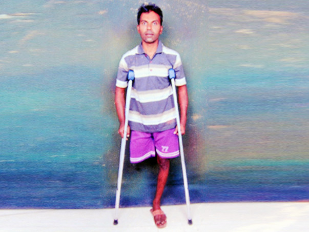 Help Joseph Get A New Leg