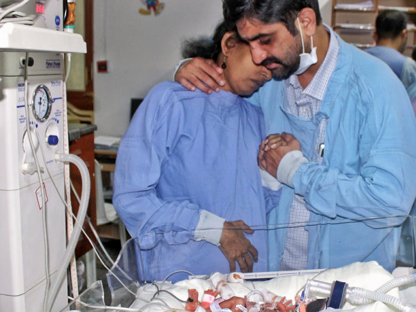 25-Days-Old Extremely Premature Twins Struggle To Breathe, Need Help