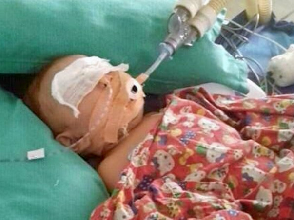 HELP SNIGDHARAAG FIGHTING LUNG INFECTIONS AND
SPINAL CHORD INFECTIONS