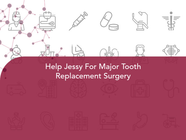 Help Jessy For Major Tooth Replacement Surgery