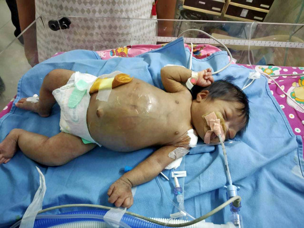 My daughter is fighting for her life from day one
