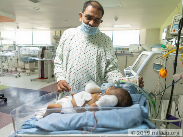 Help Baby of Sridevi to survive