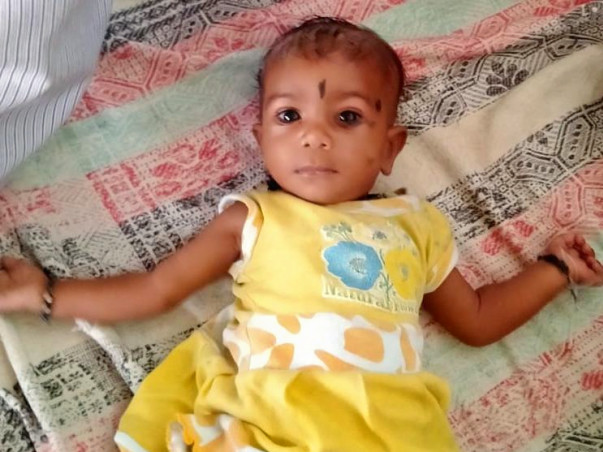 6 months old baby need a heart surgery