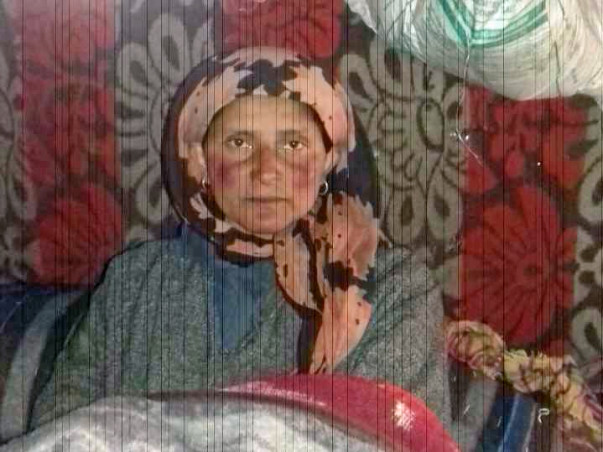 Help Gulshana Recover From Chest Disease