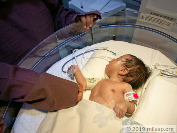 24 Hours To Keep This Newborn Baby's Heart Beating
