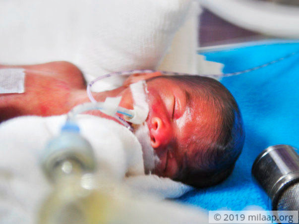Help Akshaya and Mayur save their prematurely born twins