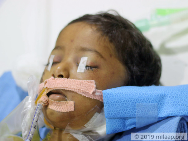 Single Mother's Son Is Fighting For Life In ICU After He Met Accident
