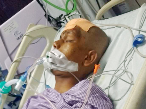 Head injured - complicated operation in head