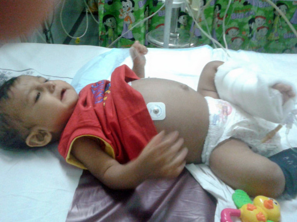 Save Burhanuddin, Liver transplant required
