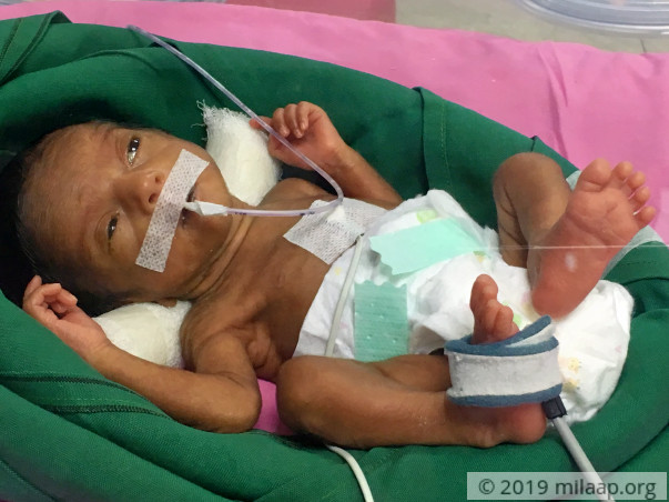 Help Priyanka Deshmukh save her premature twin babies