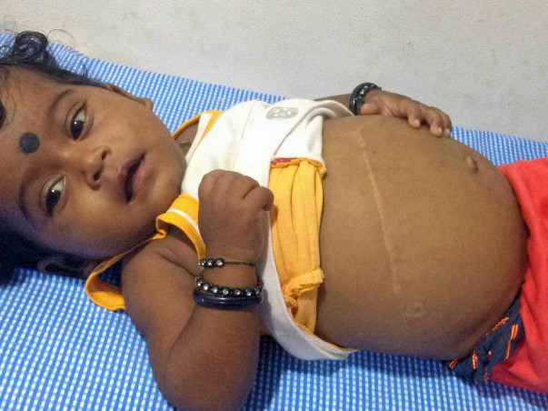 Help this 7-month-old undergo a liver transplant