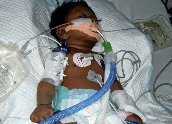50 day Old kid with pneumonia needs money for treatment