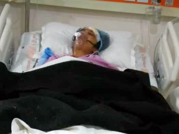 Help My Friend Reena Recover From Bilateral Fracture