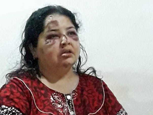 Help My Aunt Neeta Undergo An Operation
