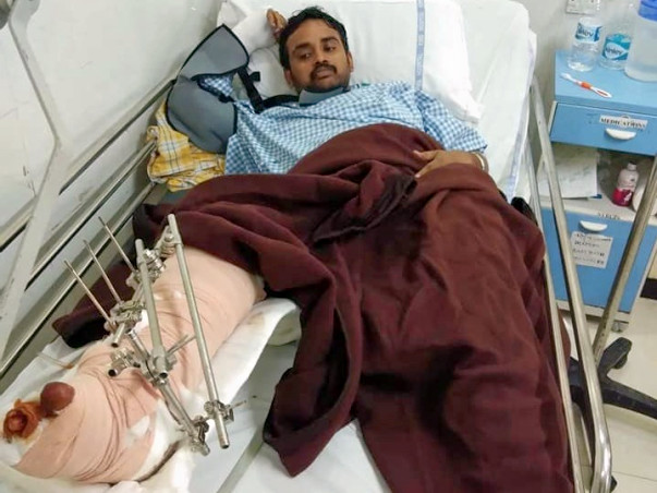 Help Ajay,Bus Accident- Leg Injury, Parents expired,Poor Family