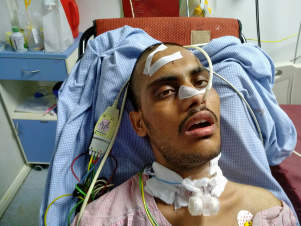No One Knew That 22-Year-Old's Chronic Headaches Were From Brain Tumor