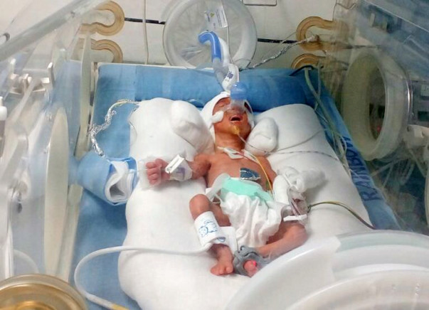 Require Help For New Born-Premature Babies (Twins)