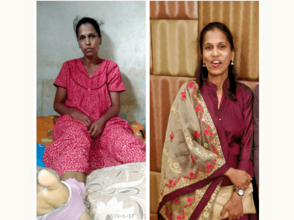 Lets Support Sakshi patil to stand on her feet