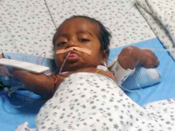 Help Baby SaiChand Recover
