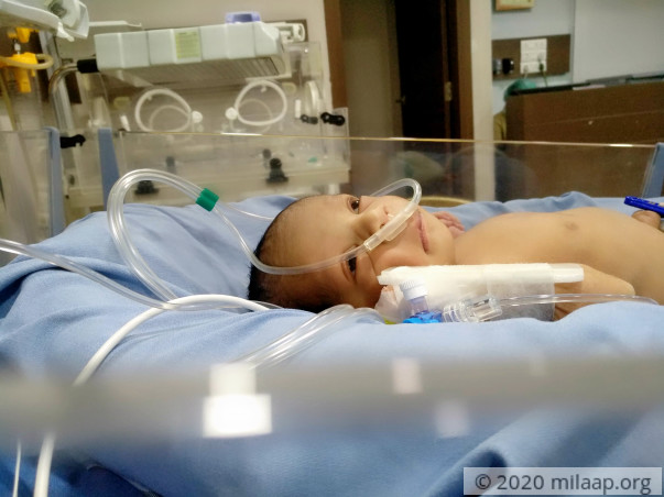 4-day-old Baby Will Suffocate To Death Unless He Has A Surgery