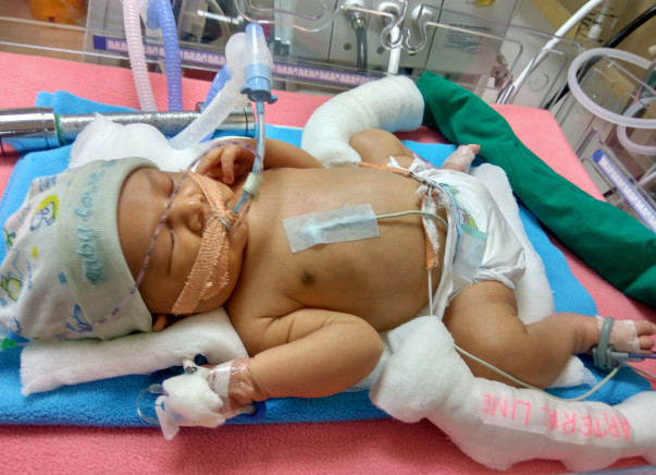 Help Save My Baby Boy (B/O Suvarna Narendra Patil)