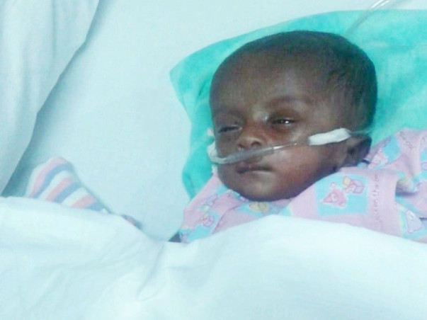 Help Little Saayishri Undergo Open Heart Surgery
