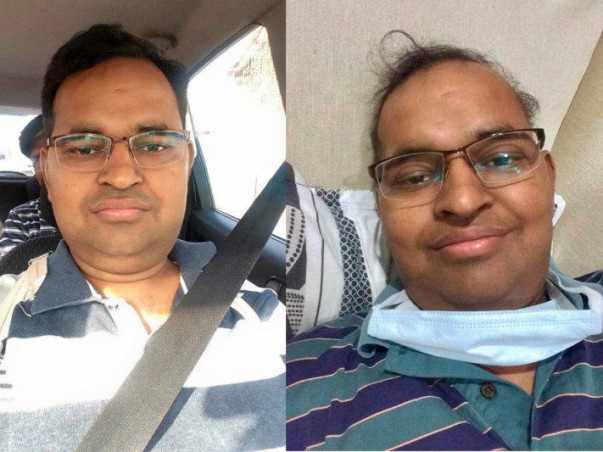 Vineet's fight against blood cancer (Please show your generosity)