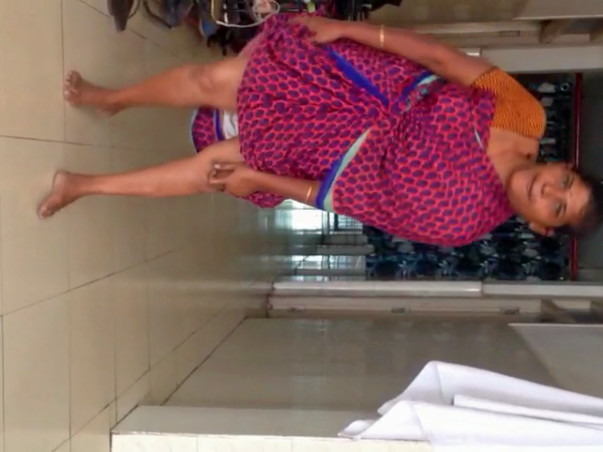 HELP KALA MARY FOR ARTIFICIAL LEG