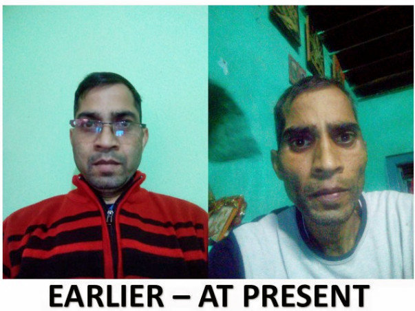 Help Me Fight Against Liver Cancer