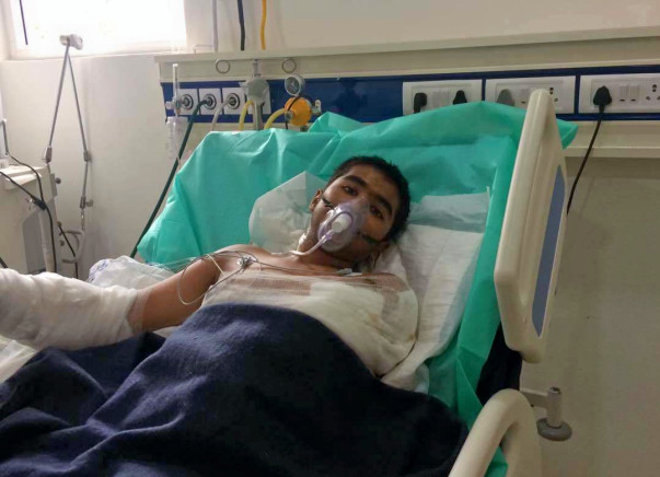 Help Cavin Recover From Burns & An Amputation Caused By Faulty Wiring